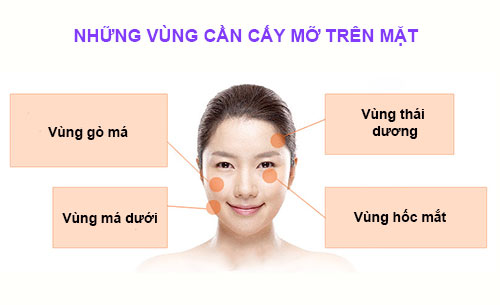 cấy mỡ tại thẩm mỹ kangnam