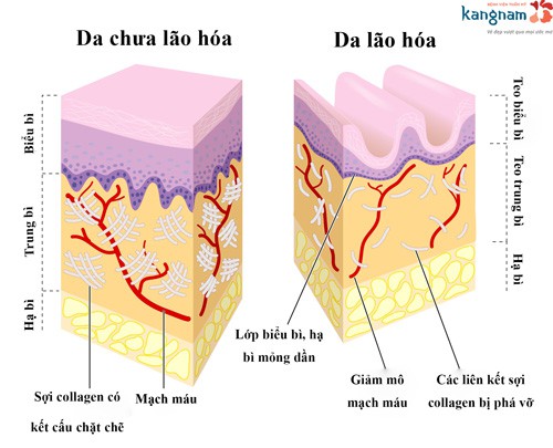 da chùng nhão