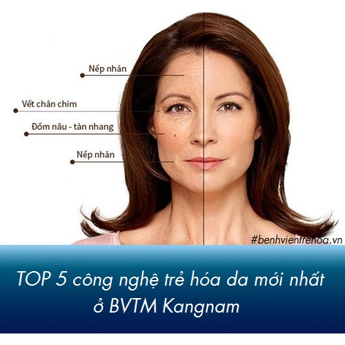 TOP 5 công nghệ trẻ hóa da mới nhất tại Kangnam