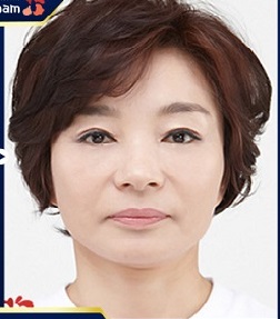 Bật mí cách xóa nếp nhăn rãnh mũi má giúp bạn trẻ ra 10 tuổi